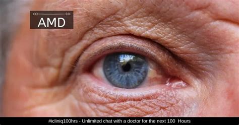 Age Related Macular Degeneration Amd Types Stages Causes