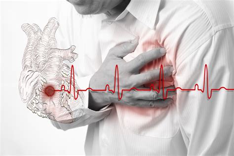 Come Riconoscere E Curare Uninsufficienza Cardiaca Il Tuo Farmacista