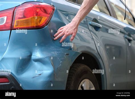 Driver Hand Examining Dented Car With Damaged Fender Parked On City