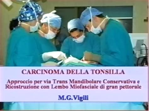Svuotamento Latero Cervicale Prof Maurizio Vigili