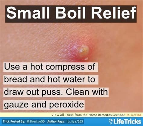 Boil Relief Home Remedy For Boils Home Remedies Remedies