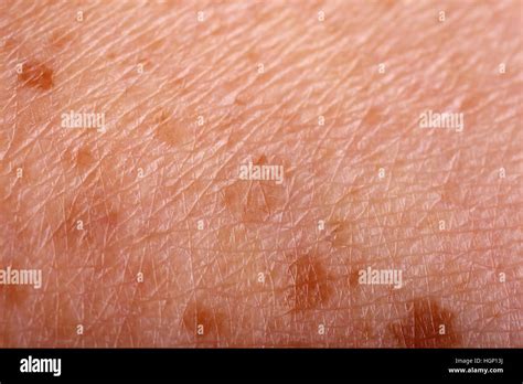 Macro Of Age Spots On Old Skin With Wrinkles Stock Photo Alamy