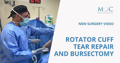 Video Rotator Cuff Tear Repair And Bursectomy Manhattan Orthopedic Care