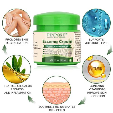 Eczema Cream Eczema Therapy Psoriasis Cream For Dry Irritated Skin Itch Relief Dermatitis