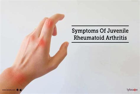 Symptoms Of Juvenile Rheumatoid Arthritis First Signs When You Might