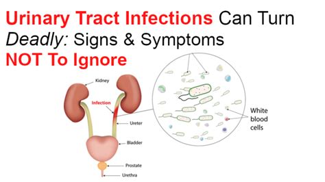 Urinary Tract Infections Can Turn Deadly Signs And Symptoms Not To