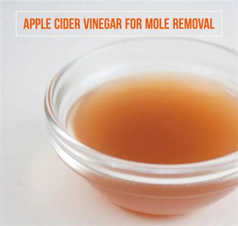 How To Remove Moles With Apple Cider Vinegar Wellnessguide