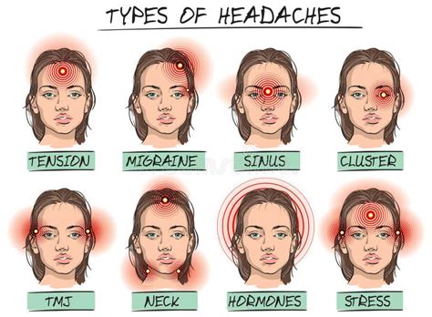 Headache Types Outline Icons Set Various Symbols Of Human Head With
