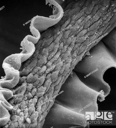 Scanning Electron Microscope Sem Image Showing A Human Hair With The