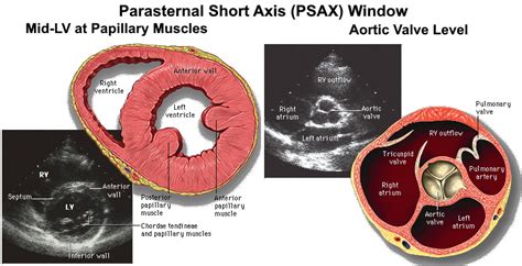 Parasternal Short Axis Psax Window Pocus Echocardiogram Grepmed