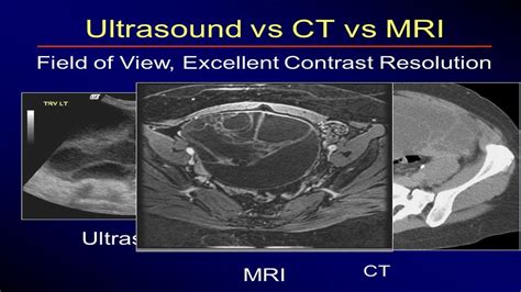 What's unique about mri imaging is that this process does not use ionizing radiation during the scan, unlike ct scans. CT Scan Vs MRI Vs Ultrasound, Which one is better? - YouTube