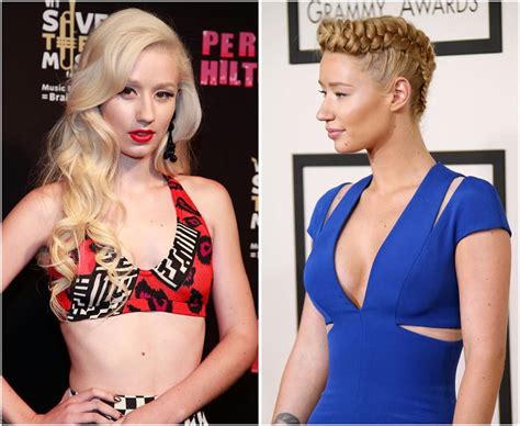 Iggy Azalea Before And After Pictures Hint She Has Undergone More Plastic Surgeries Than She