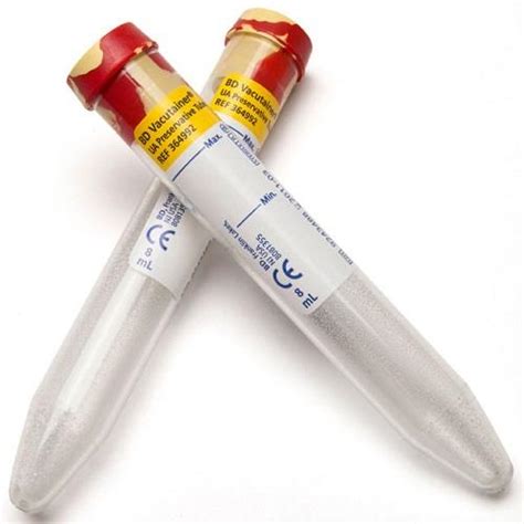 Vacutainer Plus Plastic Conical Bottom Tube With Preservative For