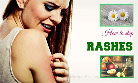 18 Tips On How To Stop Rashes From Spreading And Itching