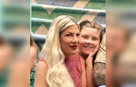 Tori Spelling Plastic Surgery Hell Injections Leave Her Face A Lumpy Mess
