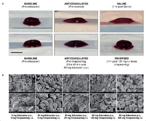 Visual Examination Of Blood Clots From Wbct Assay Preand Download