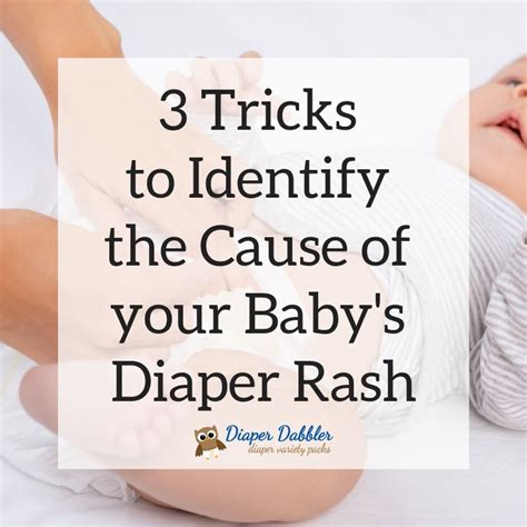 3 Tricks To Identify The Cause Of Your Babys Diaper Rash Diaper Dabbler