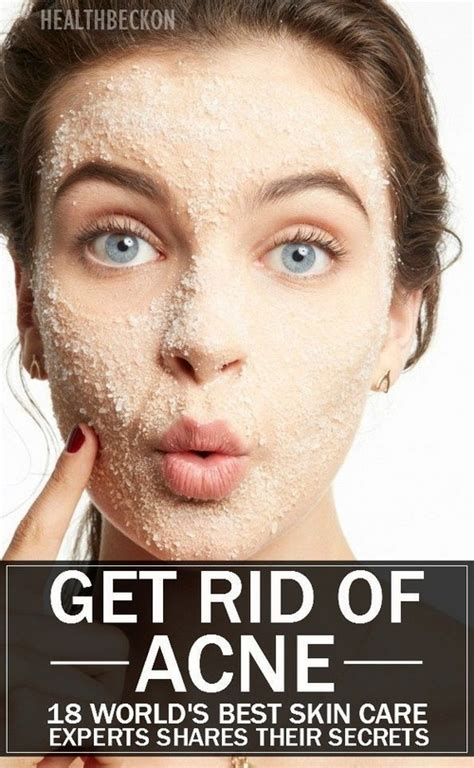 How To Get Rid Of Your Acnes Naturally At Home Fashion Corner