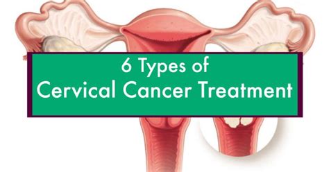6 Types Of Cervical Cancer Treatment Cervical Cancer Treatment