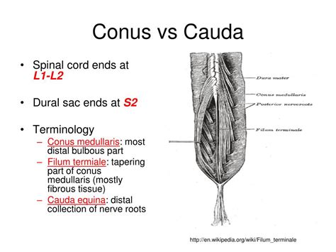 Differences Between Conus Medullaris And Cauda Equina