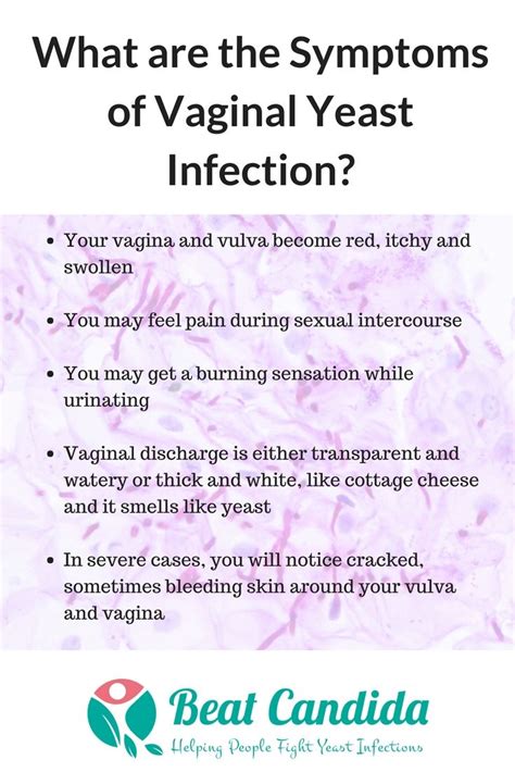 Yeast Infection Symptoms In Women