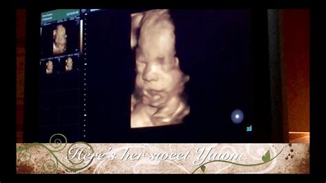 Amazing 3d 4d Ultrasound Video 30 Weeks Baby Smiling In Womb Yawning