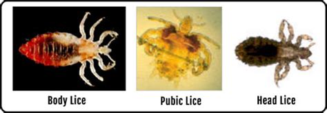 .diseases and their effect on different body functions, vaccination against infectious diseases v.helminthic diseases (i)ascariasis is caused by an intestinal endoparasite of human, ascaris from one part to other parts by the body fluids is called metastasis. Disease Outbreak Control Division | Body Lice