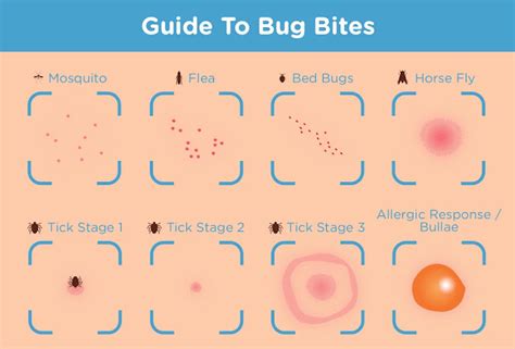 The Health Website Insect Bites And Stings