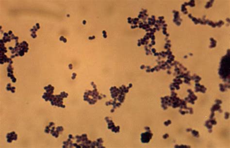 Micrococcus Microbewiki