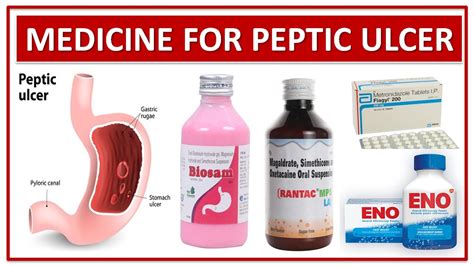 Treatment Of Peptic Ulcer Medicine Use To Treat Peptic Ulcer Disease