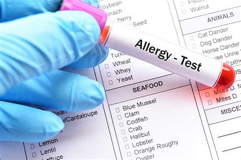 Allergy Testing In Singapore Skin Prick And Blood Test Kidsadults