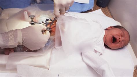 Child Circumcision An Elephant In The Hospital