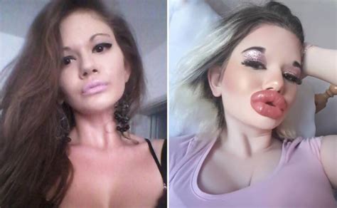 Meet Andrea Ivanova The Woman With The Biggest Lips In The World