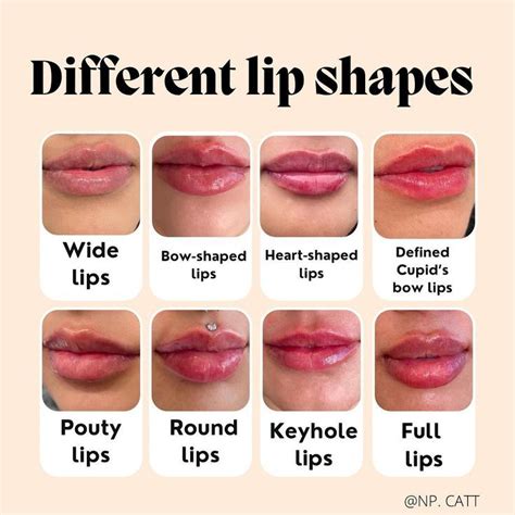 Different Lip Filler Shapes In Lip Fillers Lip Shapes Lips