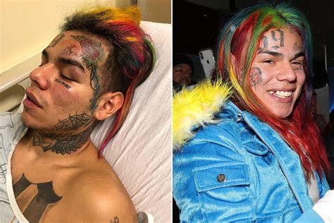 Tekashi Ix Ine Three Arrested In Brutal Beating Of Rapper At Florida