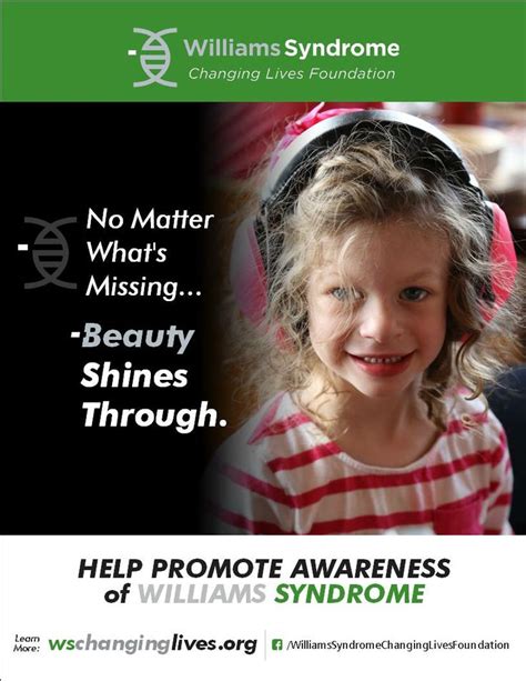 William's syndrome was first recognized as a unique disorder in 1961. 17 Best images about Williams Syndrome on Pinterest ...