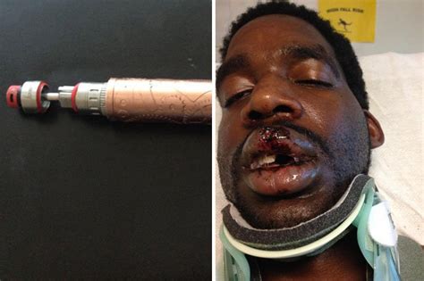 There is a larger percentage of any authentically branded electronic cigarette with a battery designed for the correct power draw. Man left with broken neck after e-cigarette explodes ...