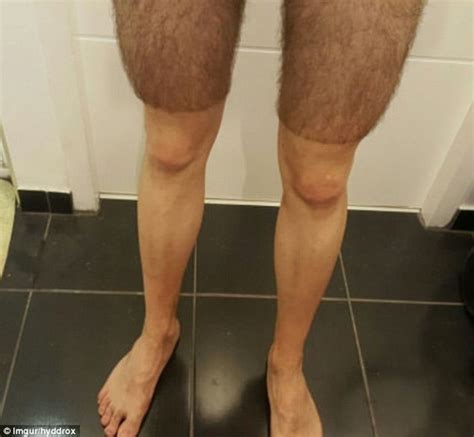 photo of a man wearing cycling shorts made of body hair after shaving his legs daily mail