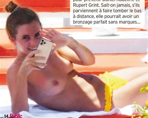 Emma Watsons Nude Leak From Her Holiday In Italy 5 Photos Thefappening