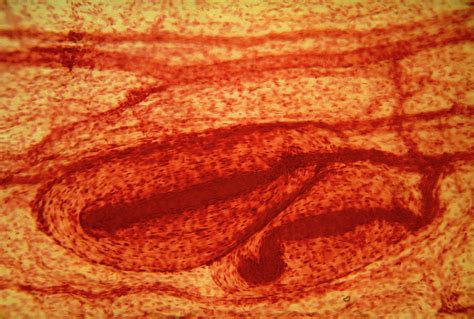 Lm Of Pacinian Corpuscles In Human Skin Photograph By Eric Grave