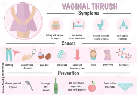 Vaginal Fungal Infection Candidiasis Infographics Of Gynecological