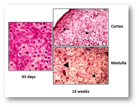 Etx Pediatrics Ch15 Fig9 Endotext