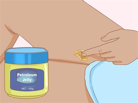 A boil is a type of skin problem that occurs as a result of deep bacterial infection in a hair follicle. 3 Simple Ways to Get Rid of Boil Scars - wikiHow