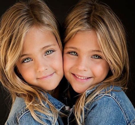 They Were Considered The Worlds Most Beautiful Twins 8 Years Ago See