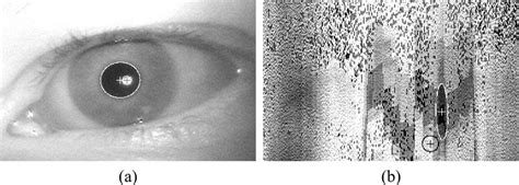 A Typical And B Distorted Eye Image With A Detected Pupil And