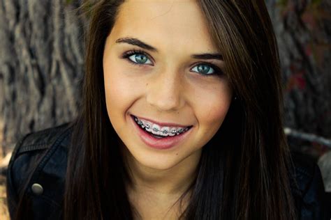 Braces Braceface Metalbraces Girlswithbraces Braces Girls Cute