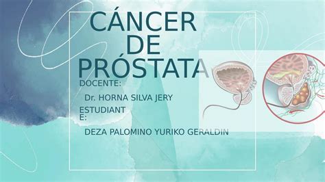 Cáncer de próstata Yuriko Deza Palomino uDocz