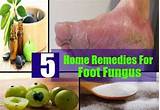 Home Remedies For Fungus Between Toes Photos