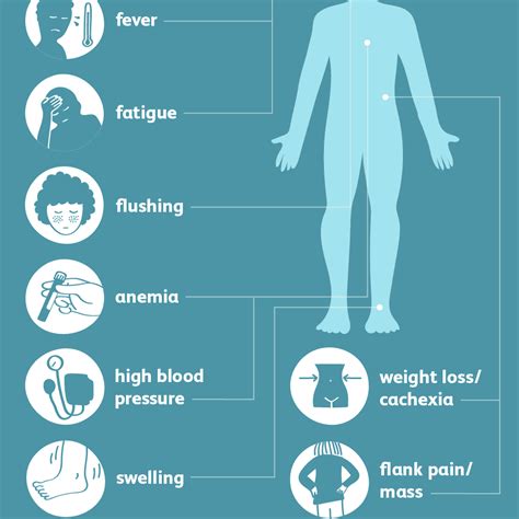 Kidney Cancer Overview And More