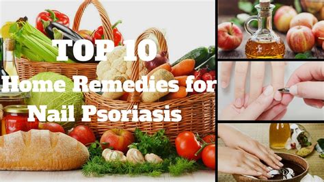 Top 10 Home Remedies For Nail Psoriasis Rise Health Youtube